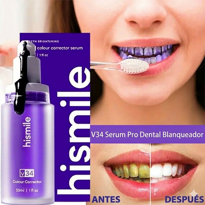 EverEase V34 Pro Sérum  Blanqueador   Hismile