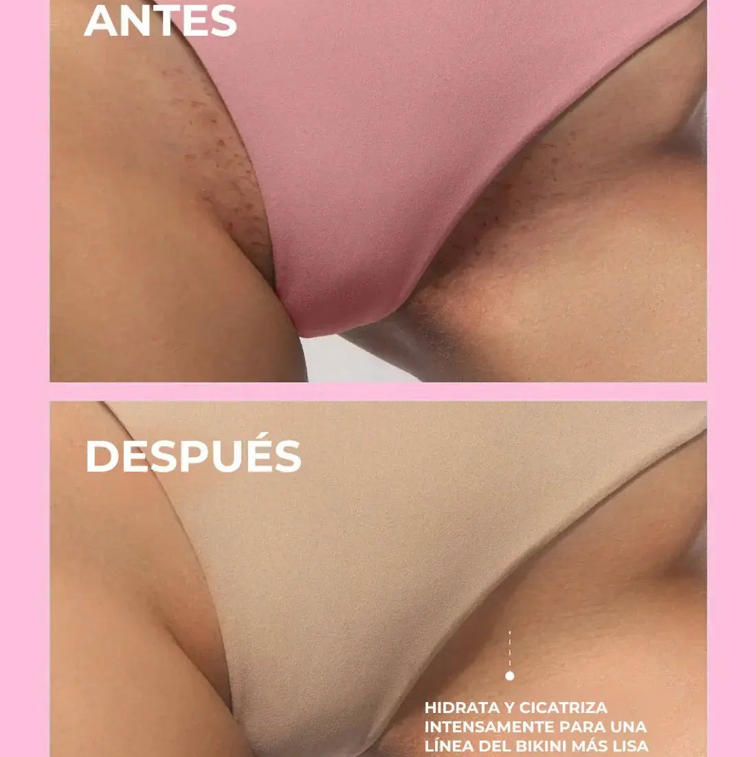 Everease Aceite Aromático After Shave